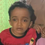 anak penderita hidrosefalus halmahera selatan Media Berjaringan Indonesia Timur