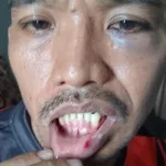 korban Media Berjaringan Indonesia Timur