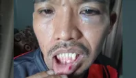 3 Petugas Rutan Kelas IIB Soasiu Keroyok Tahanan Maba Sangaji, Korban Babak Belur 21 korban Media Berjaringan Indonesia Timur