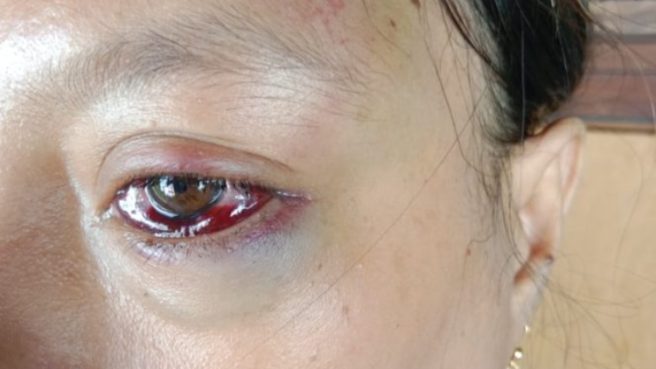 KDRT di Kepulauan Sula Media Berjaringan Indonesia Timur