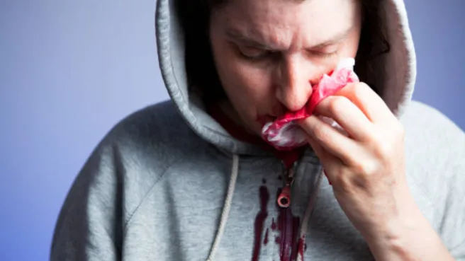 ilustrasi mimisan | Media Berjaringan Indonesia Timur