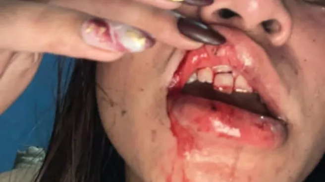 Korban KDRT oknum Polisi Halmahera Utara Media Berjaringan Indonesia Timur