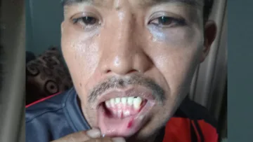 korban Media Berjaringan Indonesia Timur