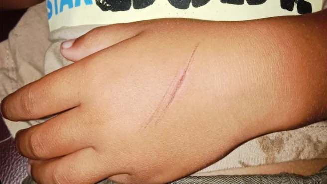 siswa TK Media Berjaringan Indonesia Timur